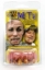 Picture of Billy Bob Meth Teeth 